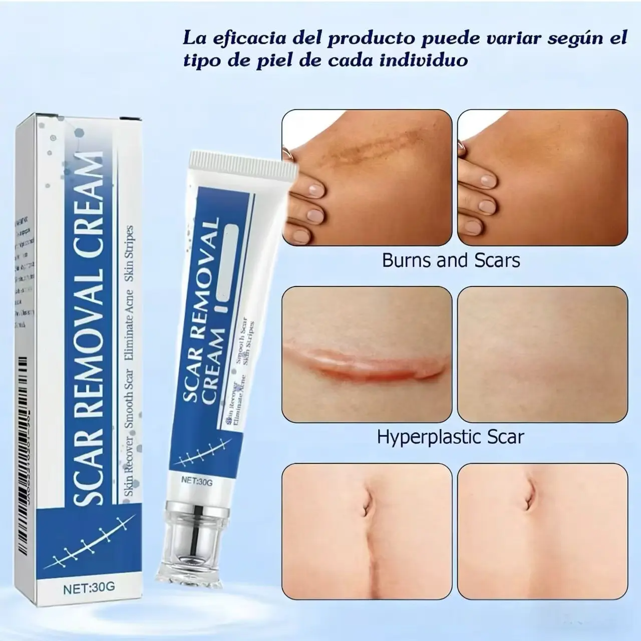 Professional Scar Removal Cream, AdvancedSilicone Skin Repair Gel for Burn