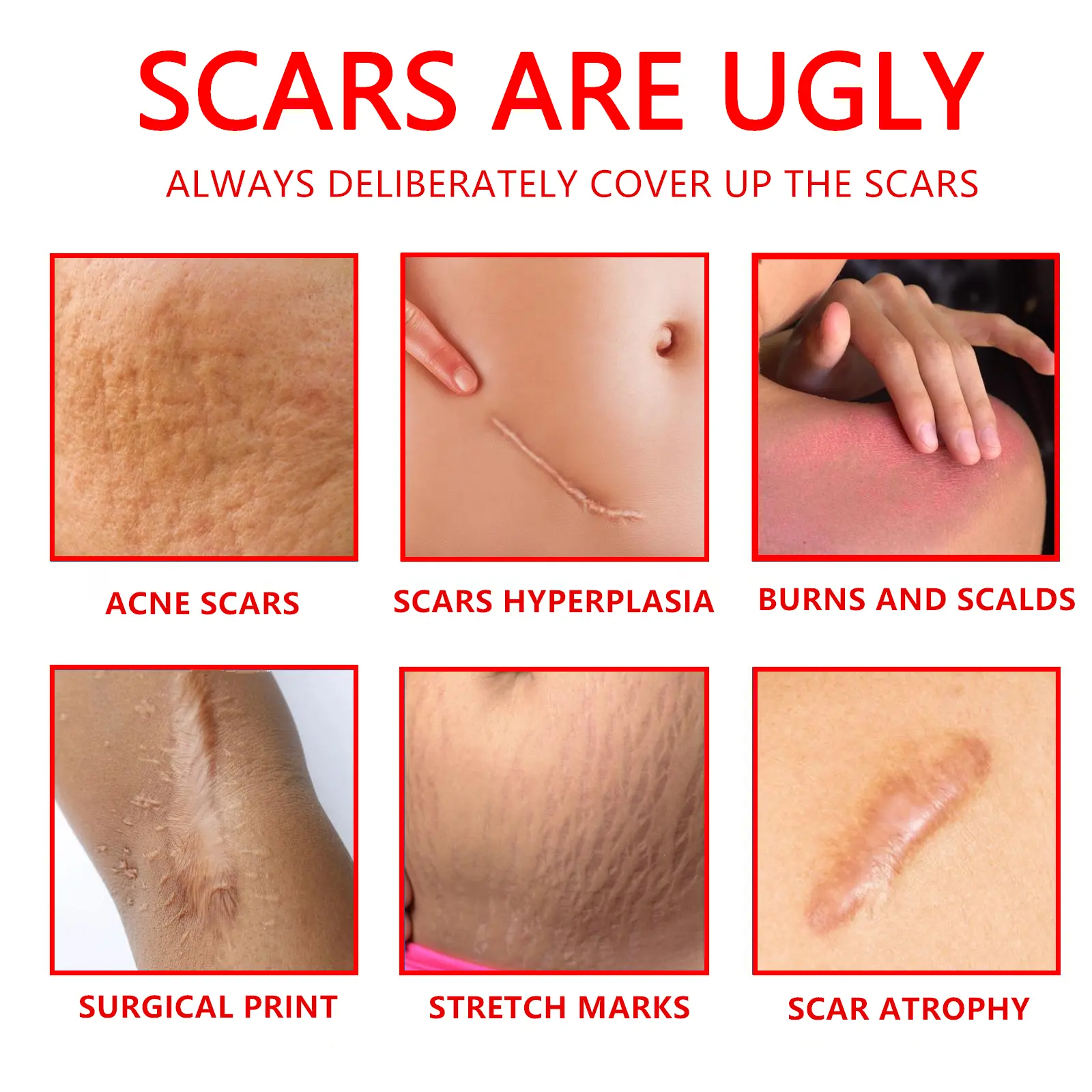 Professional Scar Removal Gel – Advanced Treatment for Keloids, C-Section, Surgery, Burn & Acne Scars