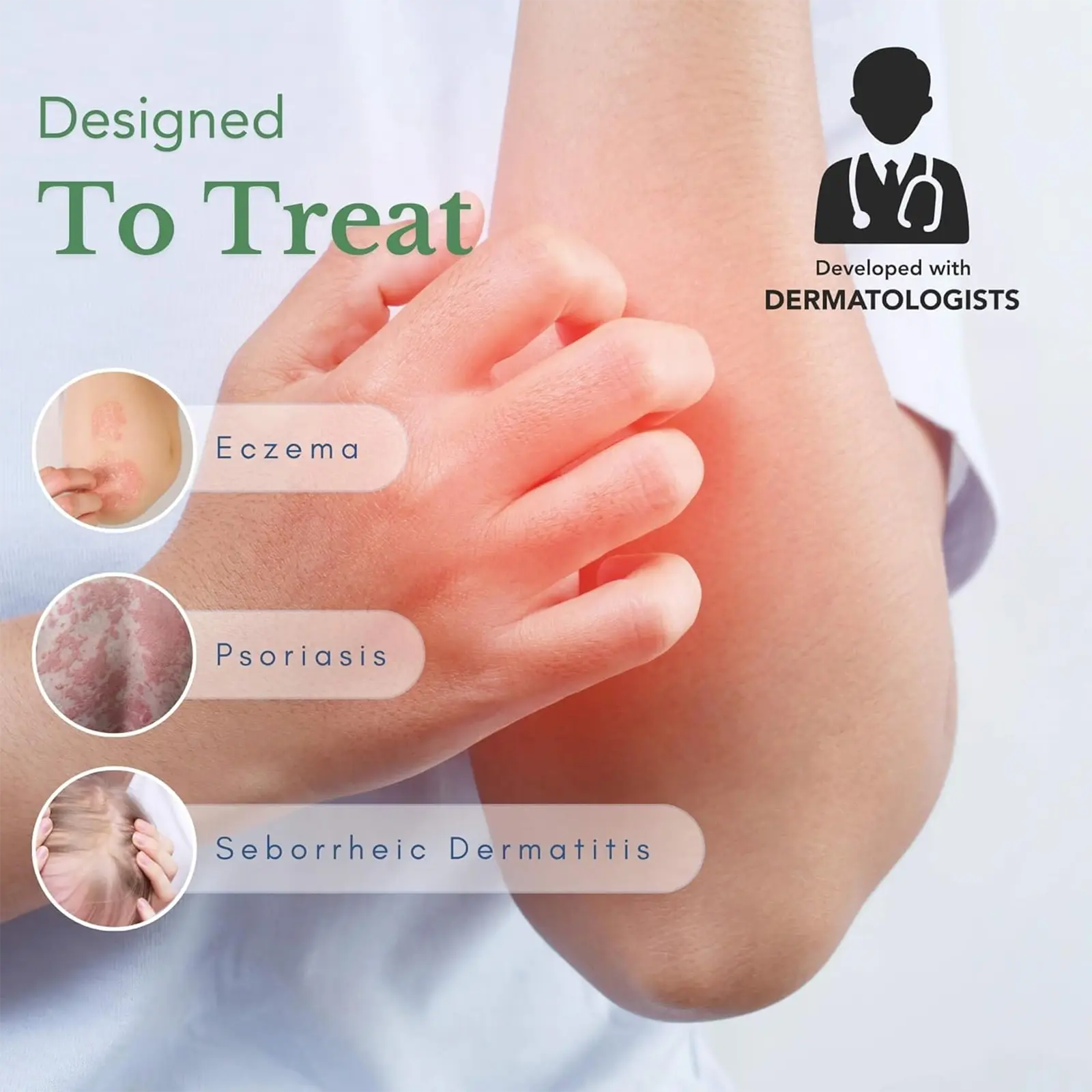 Psoriasis & Eczema Cream - Natural Herbal Ointment for Itch Relief, Dry Skin & Sensitive Skin