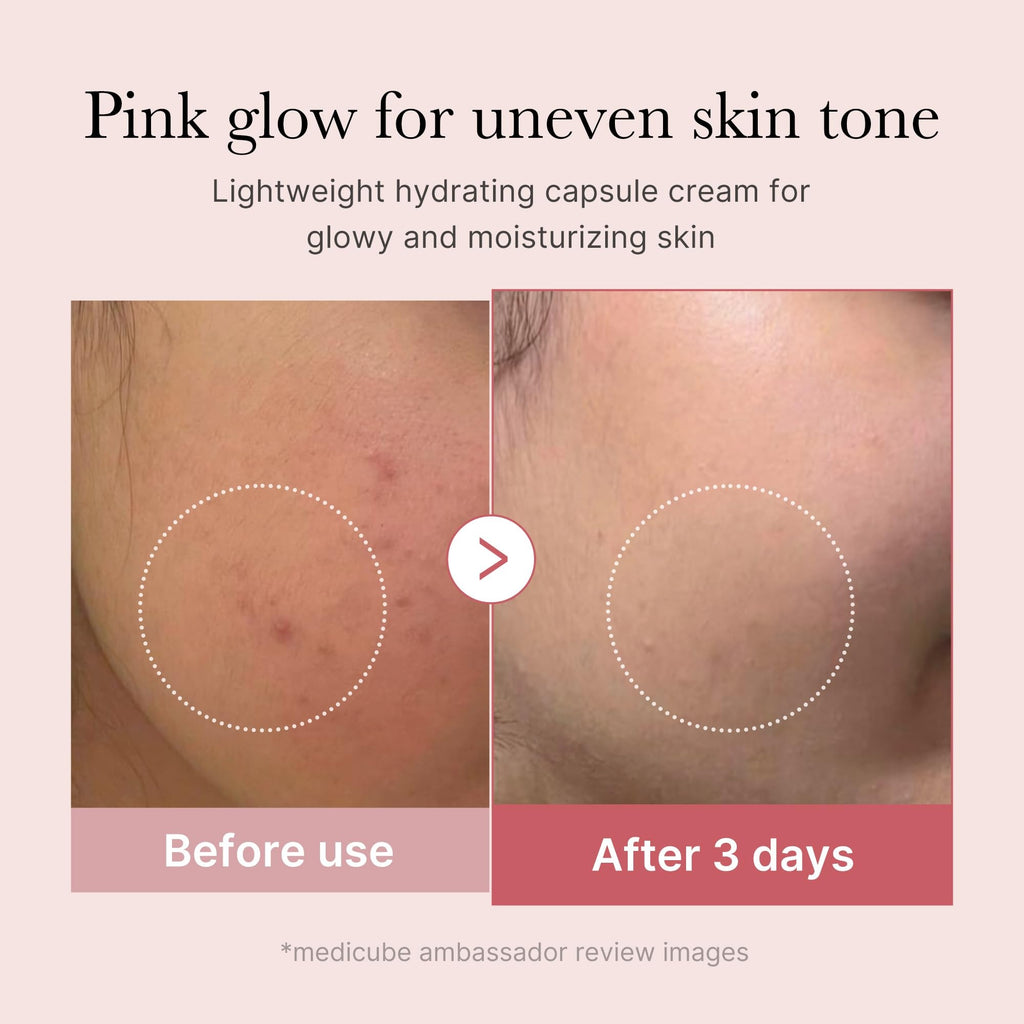 Capsule Cream with Deep Vitamin C | Liposome Vitamin C Golden Capsule for Radiance & Firm-Looking Skin III
