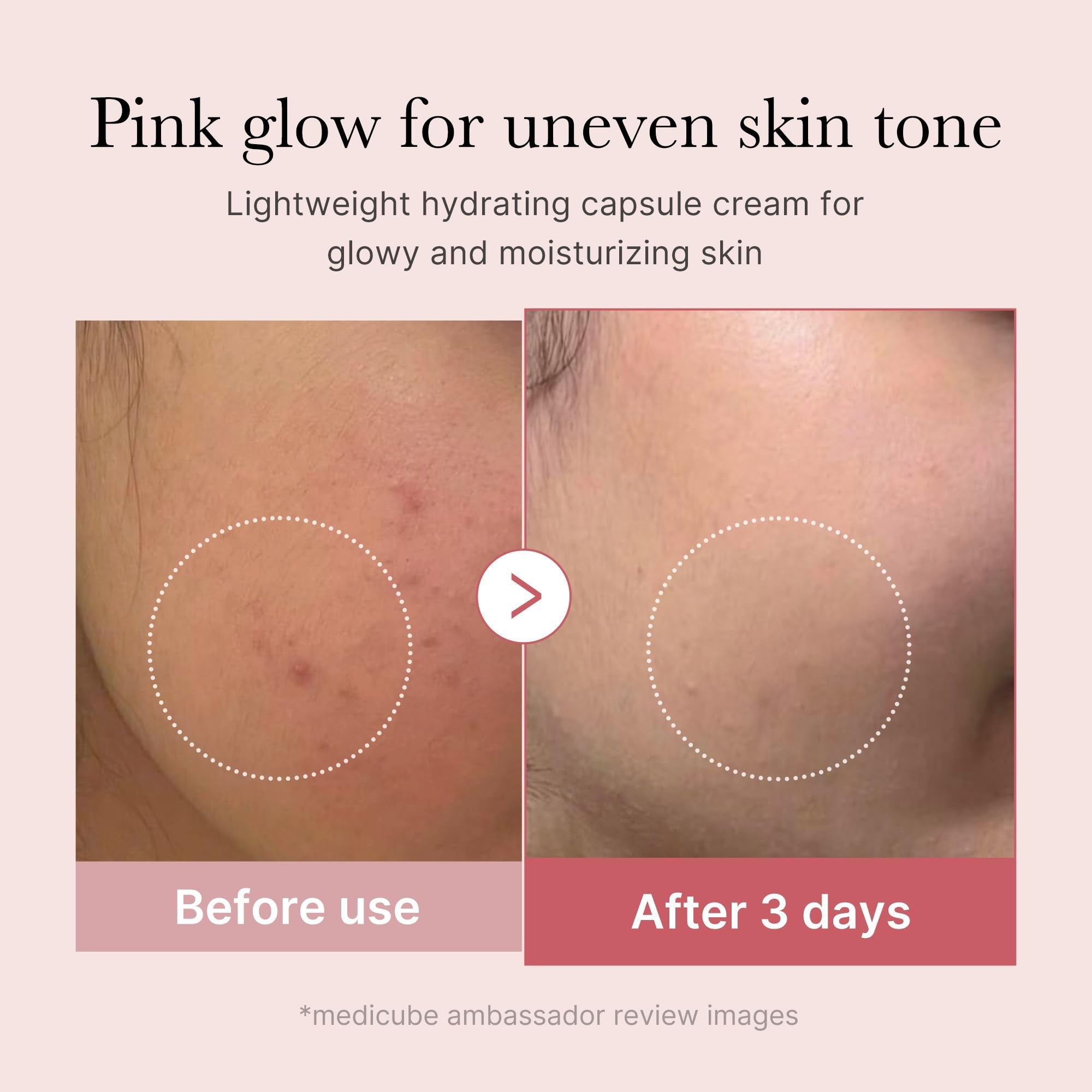 Capsule Cream with Deep Vitamin C | Liposome Vitamin C Golden Capsule for Radiance & Firm-Looking Skin III