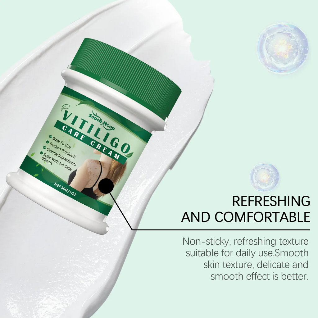 Vitiligo Treatment Cream – Natural Formula to Improve Skin Pigmentation for All Skin Types