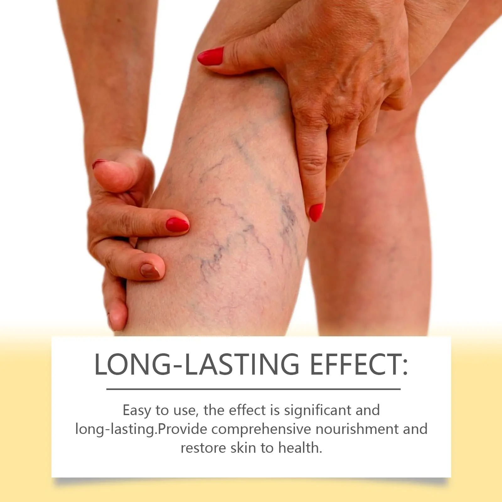 Pain & Swelling Relief Body Lotion, 100g Moisturizer  Bee Venom Extract Varicose Veins Cream,