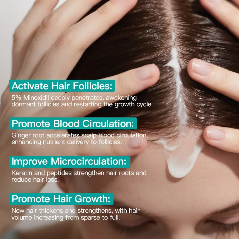 5% Minoxidil Scalp Massage Cream with Keratin & Ginger