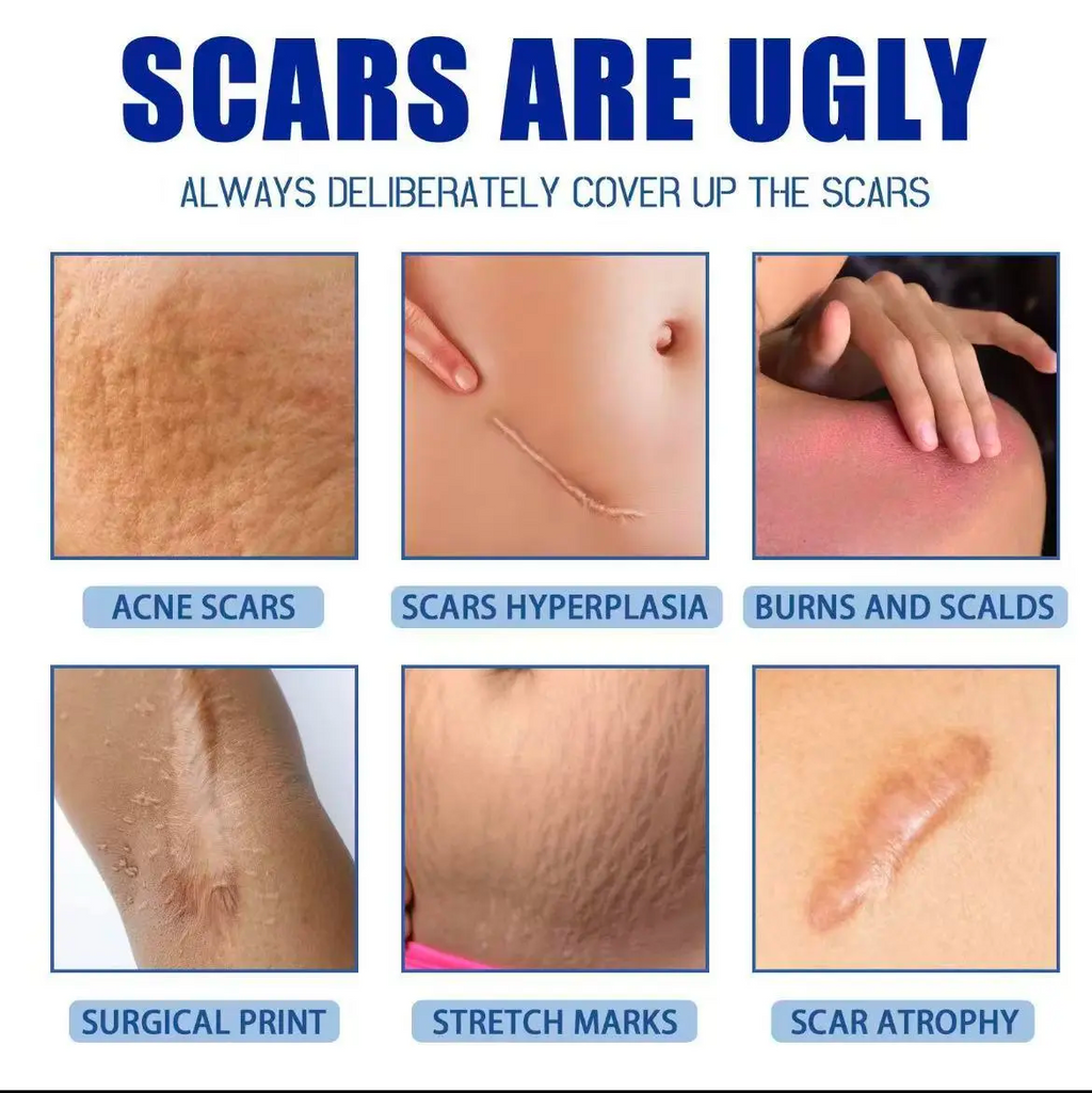 Professional Scar Removal Cream, AdvancedSilicone Skin Repair Gel for Burn