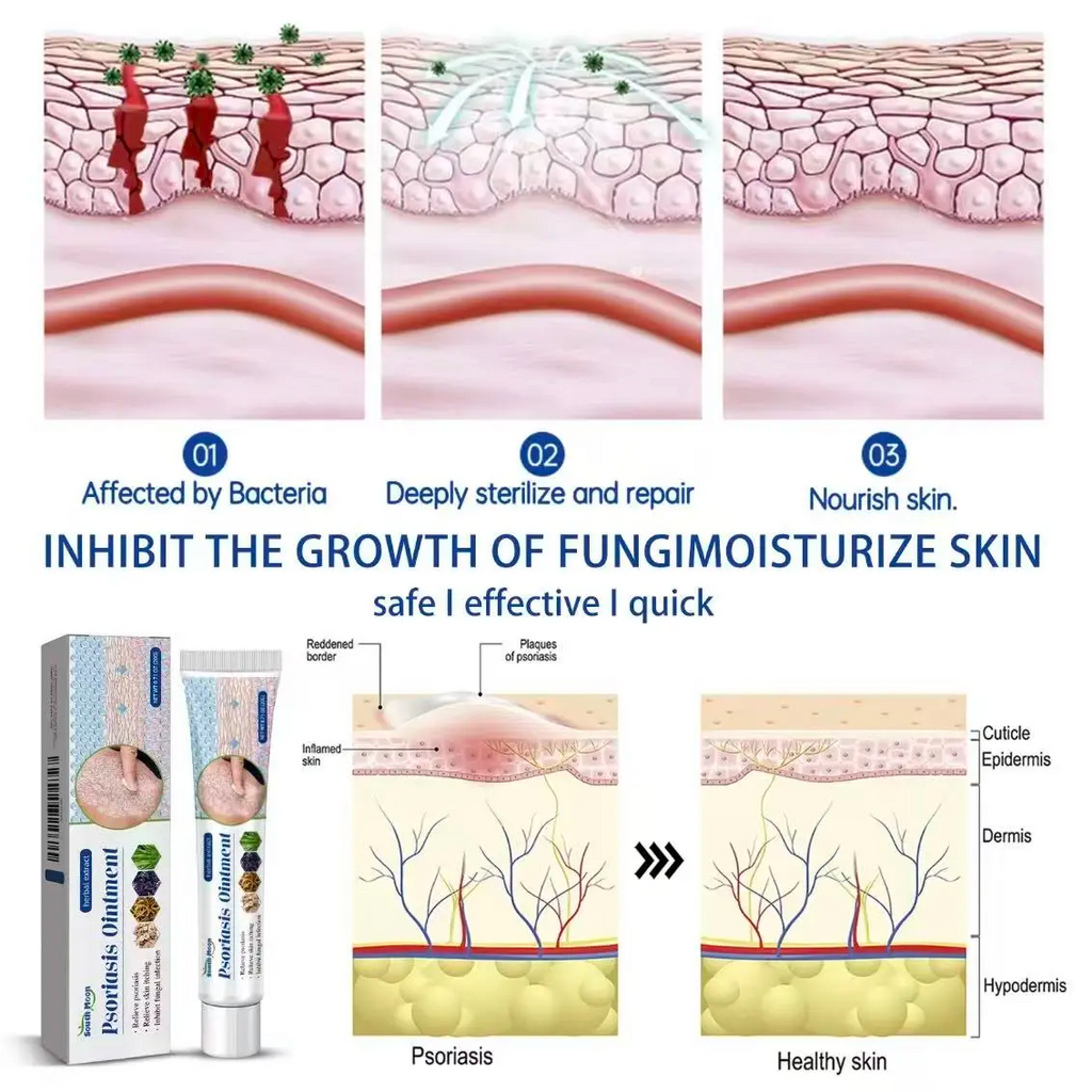 Soothing Antifungal Cream: Fast-Acting Jock Itch & Ringworm Treatment.
