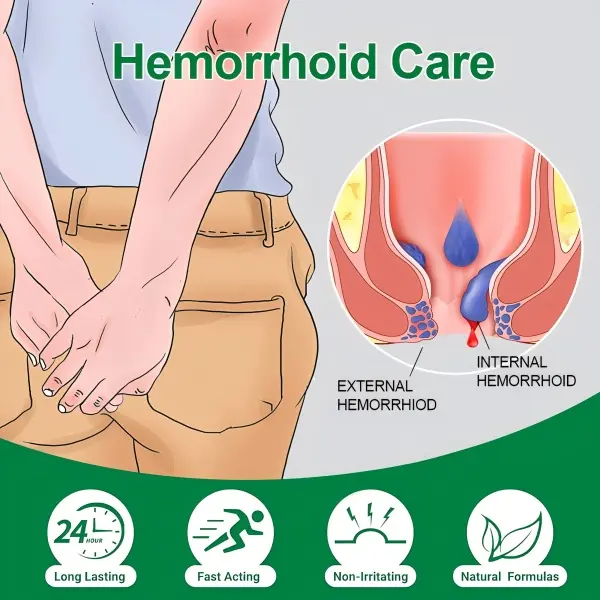 Organic Hemorrhoid Treatment Cream-Gel with Aloe Vera – Relieves Pain, Itching & Swelling | 1.4 oz with Finger Cots