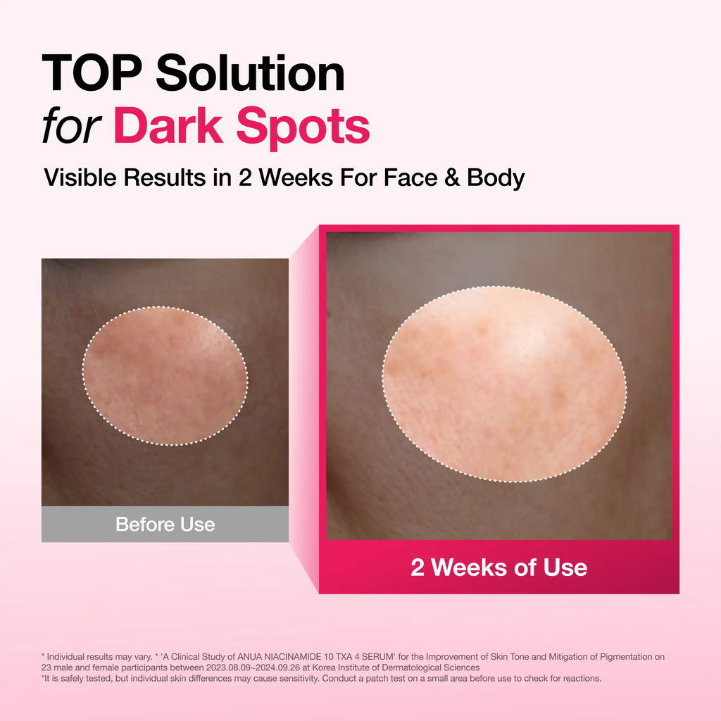 Dark Spot Correcting Serum : 10% Niacinamide+ 4% Tranexamic Acid 1.01 fl.oz. (30ml) ｜ Niacinamide Serum