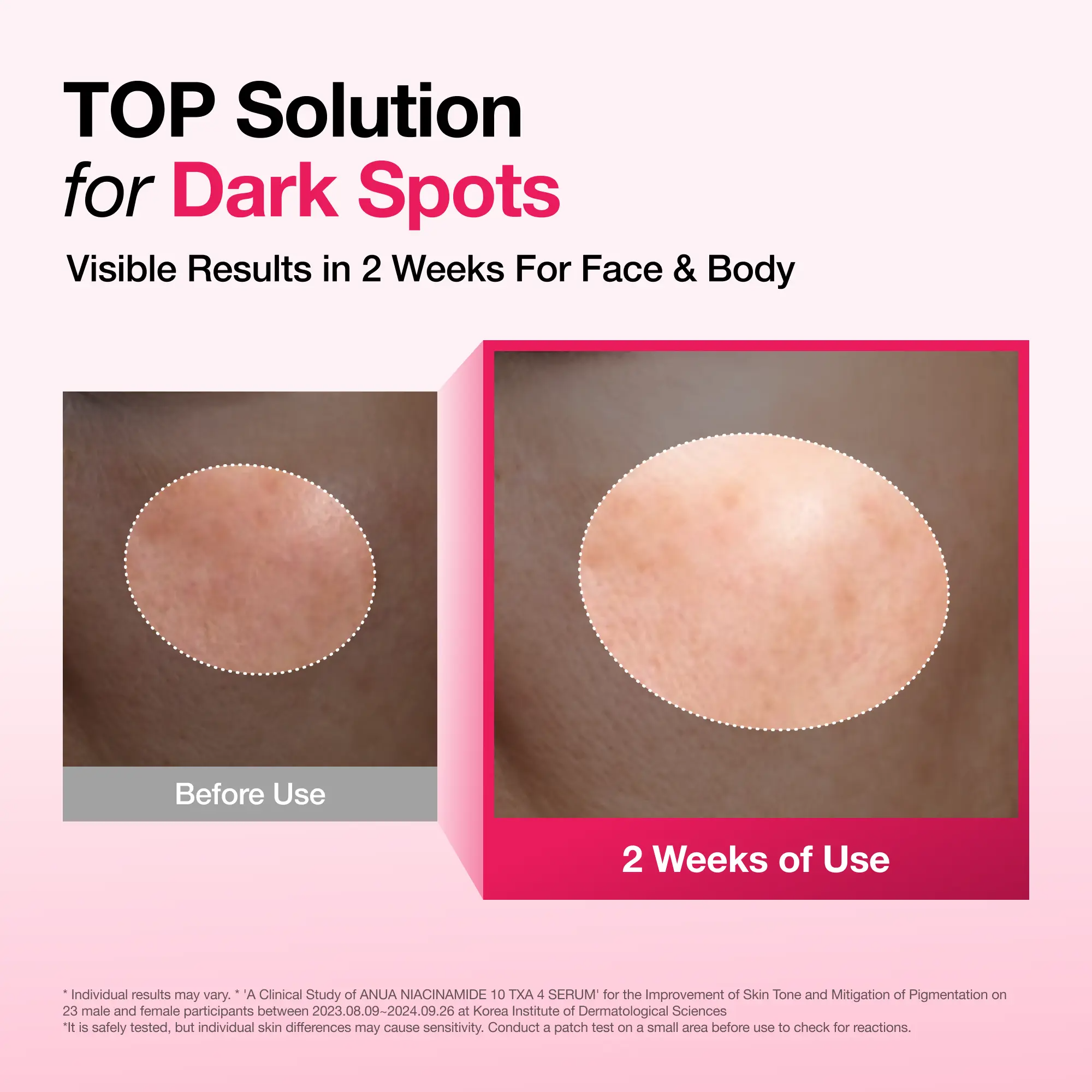 Dark Spot Correcting Serum : 10% Niacinamide+ 4% Tranexamic Acid 1.01 fl.oz. (30ml) ｜ Niacinamide Serum