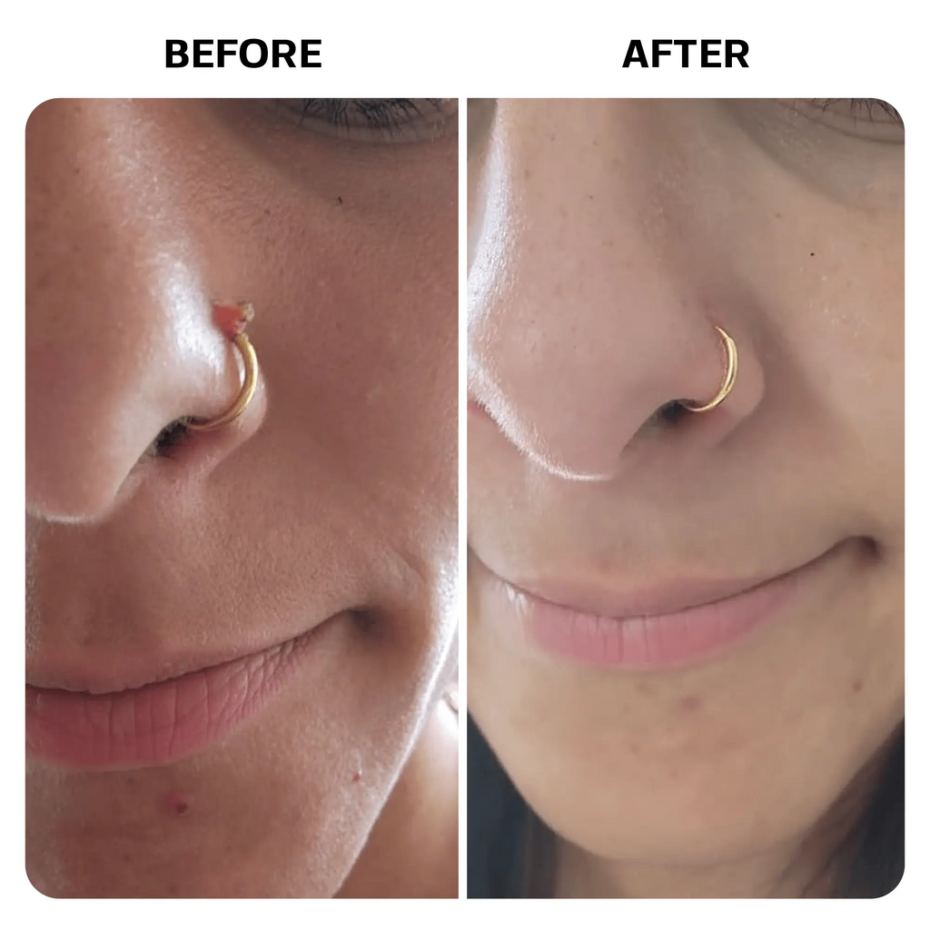 Piercing Aftercare Gel - Fastily