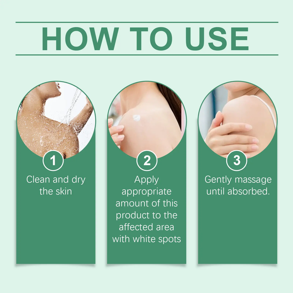 Vitiligo Treatment Cream – Natural Formula to Improve Skin Pigmentation for All Skin Types
