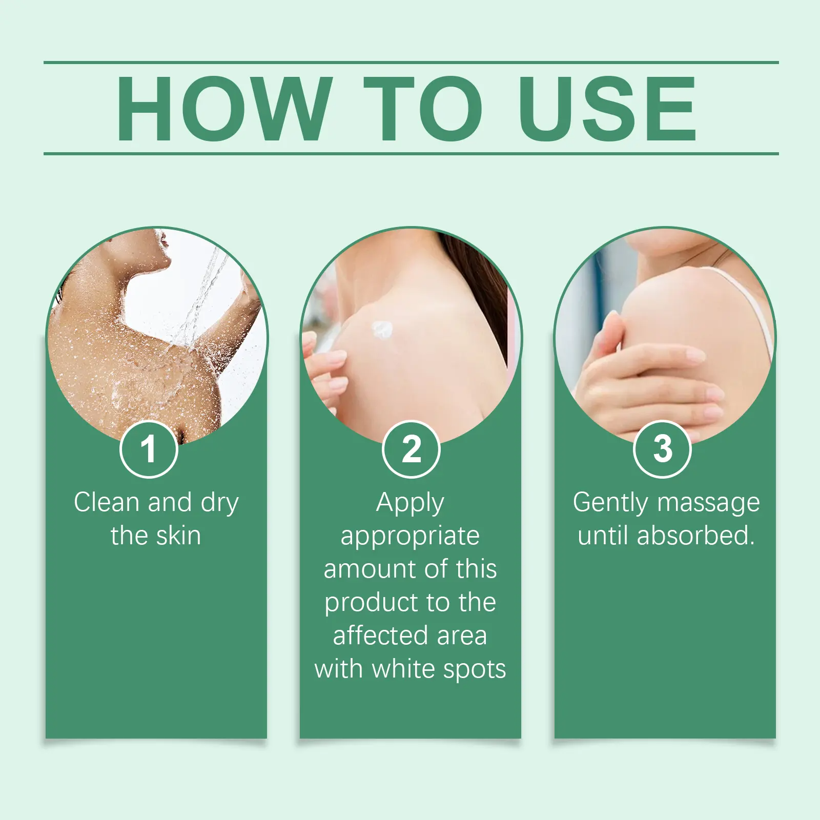 Vitiligo Treatment Cream – Natural Formula to Improve Skin Pigmentation for All Skin Types