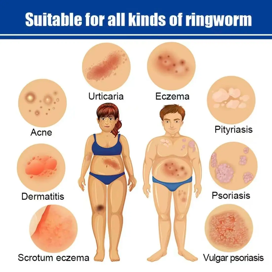 Soothing Antifungal Cream: Fast-Acting Jock Itch & Ringworm Treatment.